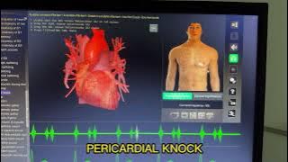 Download lagu PERICARDIAL KNOCK HEART SOUND