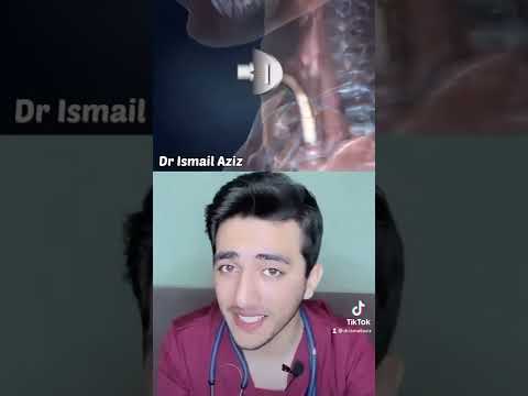 الفغر الرغامي ثقب القصبة الهوائية