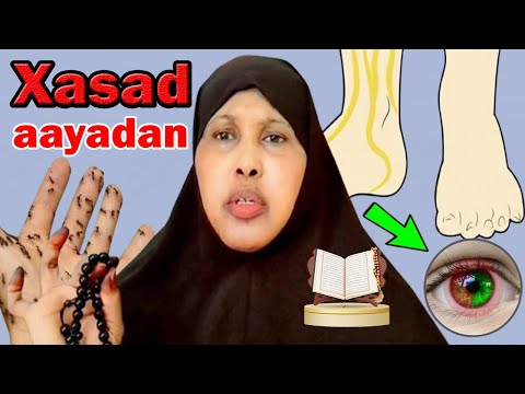 Wax Cajiib ah Arkay markaan Akhristay aayadan Gaaban Riyooyinka Xasadka iyo isha sariirta Ku Arkay