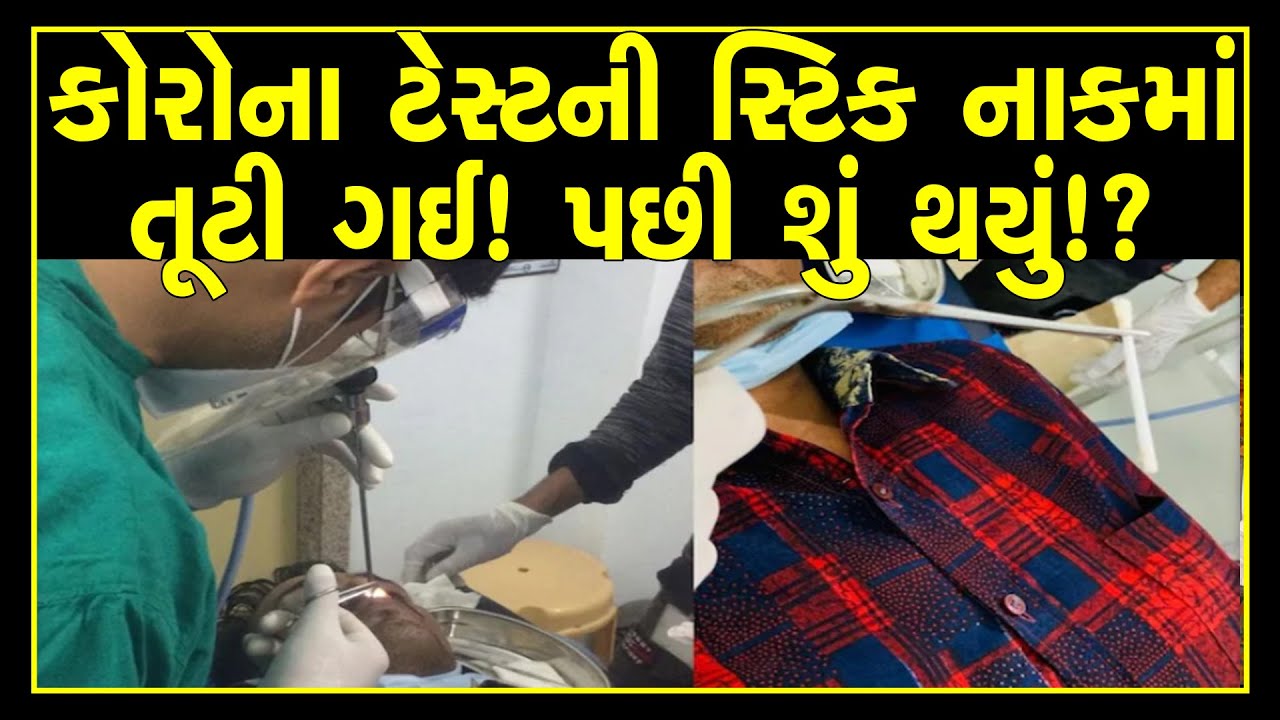 Corona swab stick breaks in nose during sampling in Rajasthan | Corona testing accident - YouTube