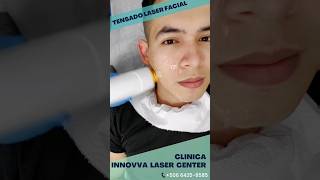 Tensado Laser Facial - 109% Recomendados #estetica #rejuvenescimento #laser #tratamientofacial
