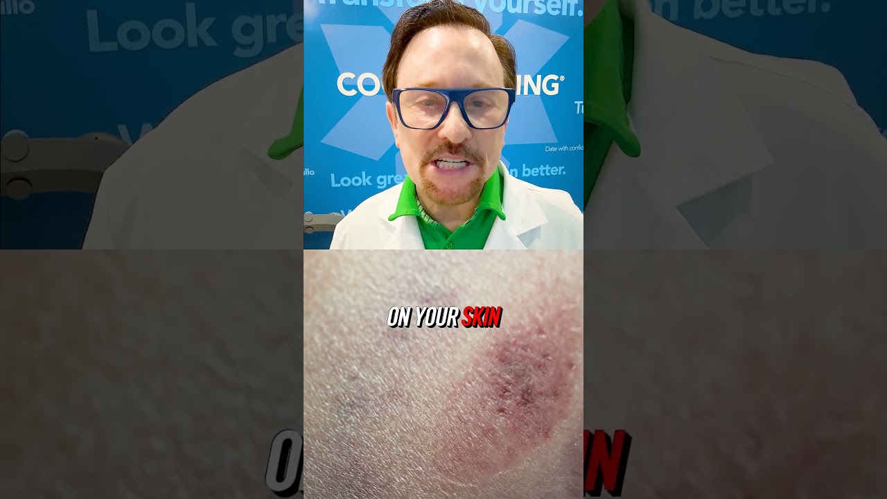 Tanning Beds' DOWNSIDES... 