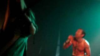 Watch Haemorrhage Excavating The Iliac Fossa video