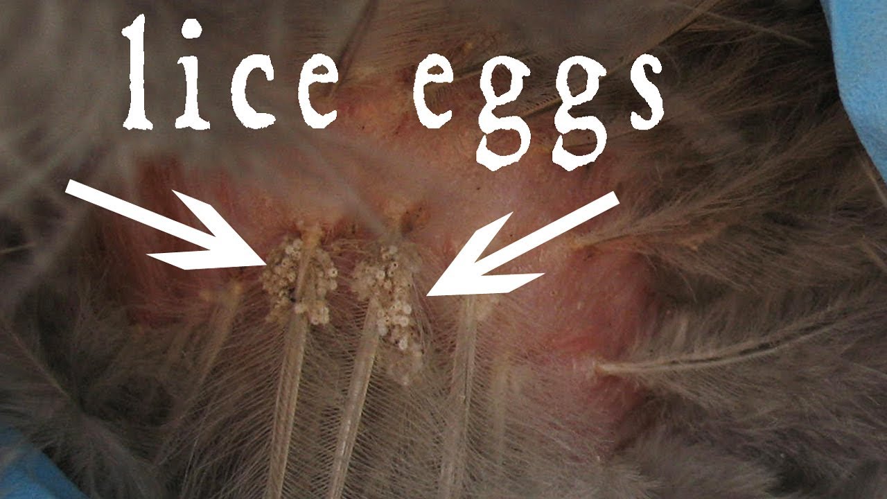 Remove Lice Eggs From Hair