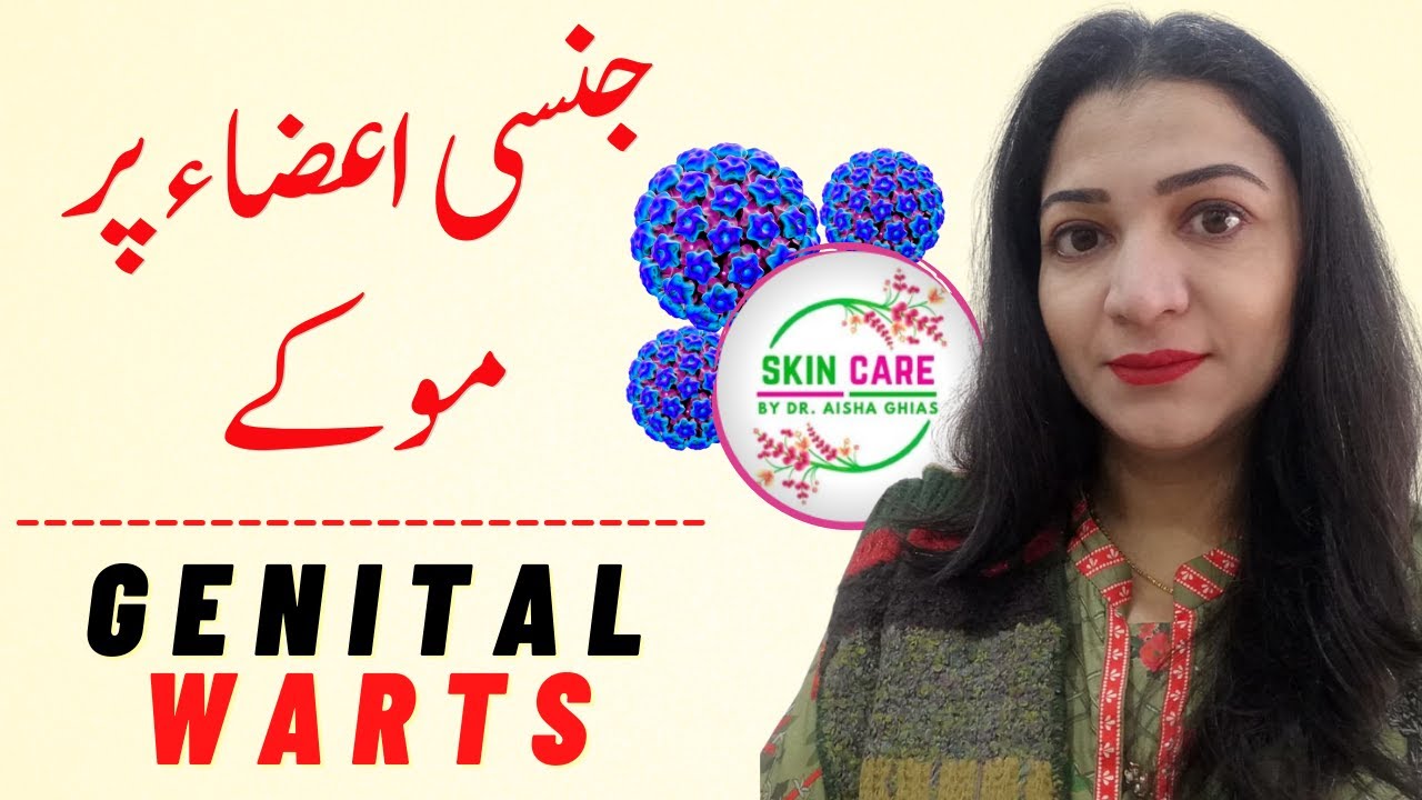Genital Warts Symptoms and Treatment Genital Warts Kya Hota Hai by Dr