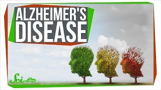 How Close Are We to Curing Alzheimer's? How Close Are We to Curing Alzheimer's?
