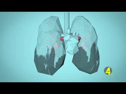 რუსთავის წინაშე არსებული რისკები - როგორ მუშაობს ზედამხედველობის სტრუქტურა 2-18-2020