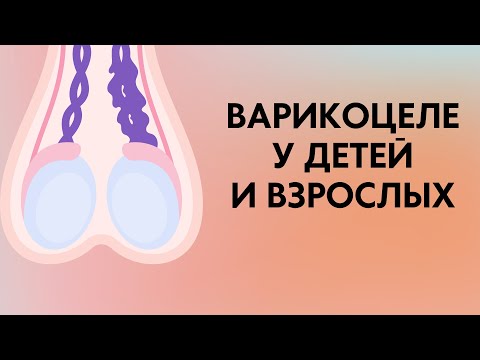 Варикоцеле у детей и взрослых | Классификация | Симптомы |Диагностика | Лечение | Лекции по урологии