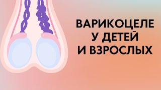 Варикоцеле у детей и взрослых | Классификация | Симптомы |Диагностика | Лечение | Лекции по урологии