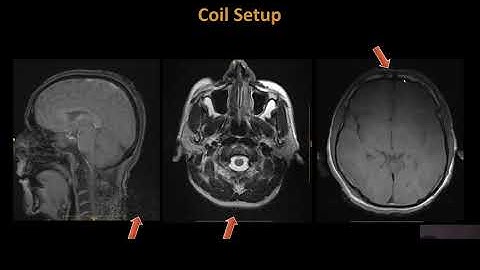 MRI Optimization Webinar
