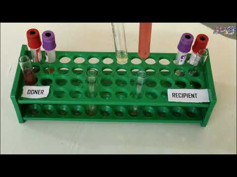 Cross Match practical in Lab || Compatibility Test || Major and Minor ...