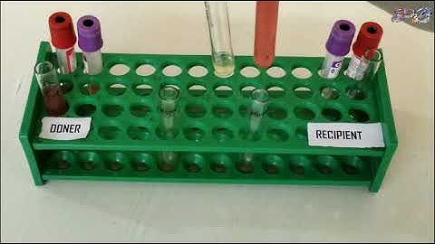 Cross Match practical in Lab || Compatibility Test || Major and Minor Cross Match in Hindi ||