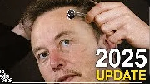 Is NEURALINK the Future of Brain Computer Interfaces?