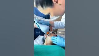 Laser Lavieen na Jess Corporal