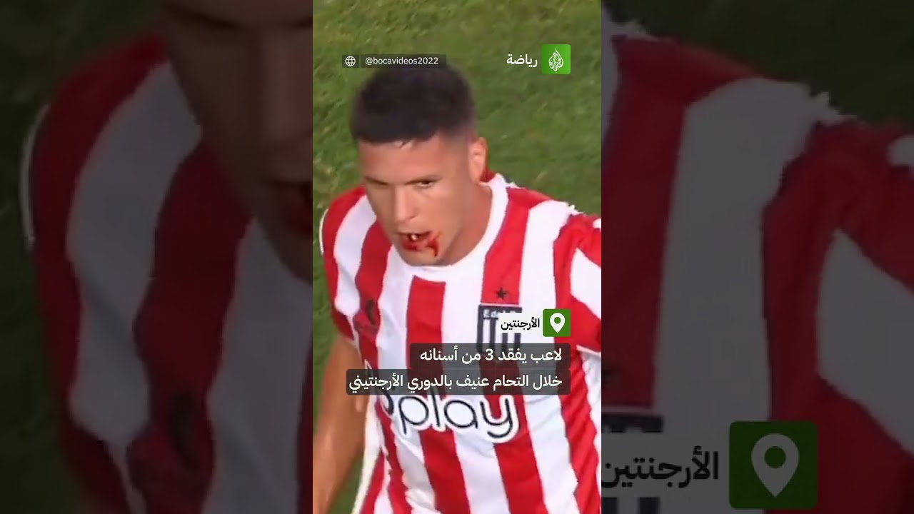 لاعب نادي استوديانتس بلاتا غيدو كاريو يفقد 3 من أسنانه بعد التحام عنيف مع مدافع سارمينتو