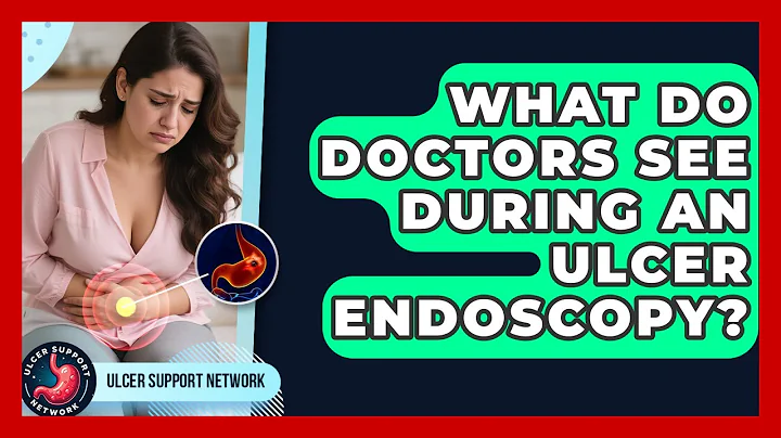 What Do Doctors See During An Ulcer Endoscopy? - Ulcer Support Network