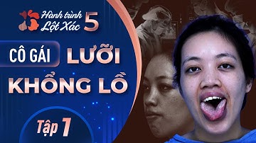 Hành Trình Lột Xác mùa 5 | Tập 1: Trần Thị Thủy - Cô gái lưỡi "khổng lồ"