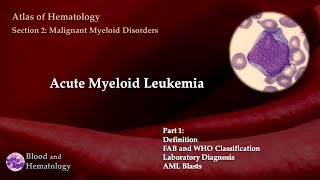 Acute Myeloid Leukemia (AML) -  Part 1