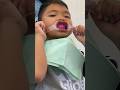 Dentista no Japão 🦷 #shorts