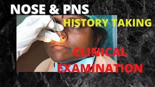 053. History Taking &  Examination of Nose & Paranasal Sinus.  #history  #clinicalexamination