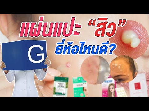 (กูรูชวนเช็ค)ไอเท็มหน้าใส “แผ่นแปะสิว” สิวยุบ ลดสิวอักเสบ  สิวแห้งไว ยี่ห้อไหนดี ?