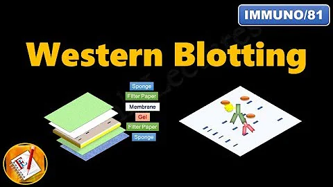 Western Blotting (Immunoblotting) : Principle and ...