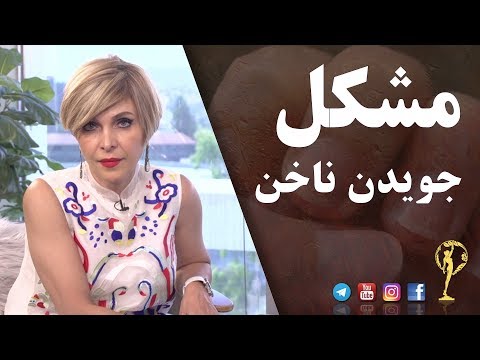 تصویری: چگونه از جویدن ناخن خود جلوگیری کنیم