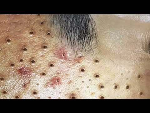 ผลสลากกินแบ่งรัฐบาล วันที่ 1 พย. 2567