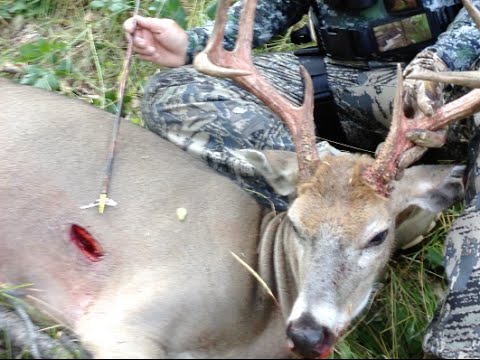 Where to Shoot a Deer While Bowhunting