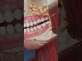 Чем может оказаться прыщ на десне?