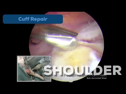 Cuff Repair Mr R A Sankey King Edward VII's Hospital Sister Agnes