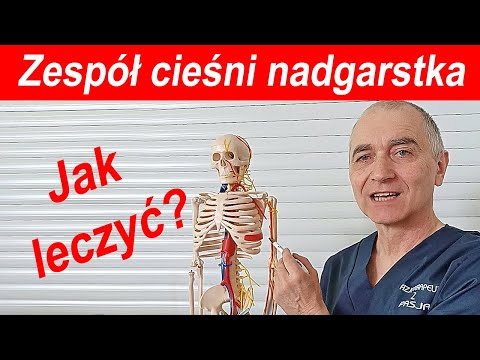 Jak leczyć zespół cieśni nadgarstka?