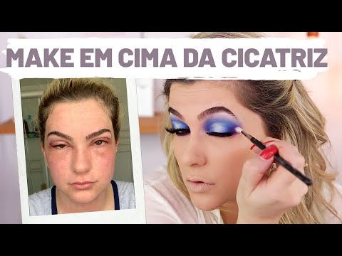 COMO DISFARÇAR CICATRIZ COM MAQUIAGEM POR ALICE SALAZAR