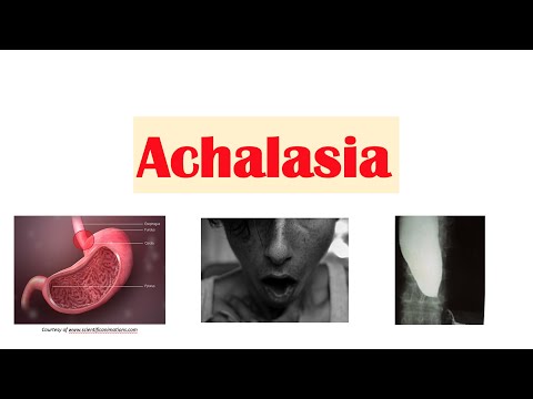 Video: Achalasi I Spiserøret - Behandling, Symptomer, årsager