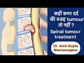 कहीं कमर दर्द की वजह Spinal tumour तो नहीं ? || Spinal tumour treatment in Delhi || Spine surgeon