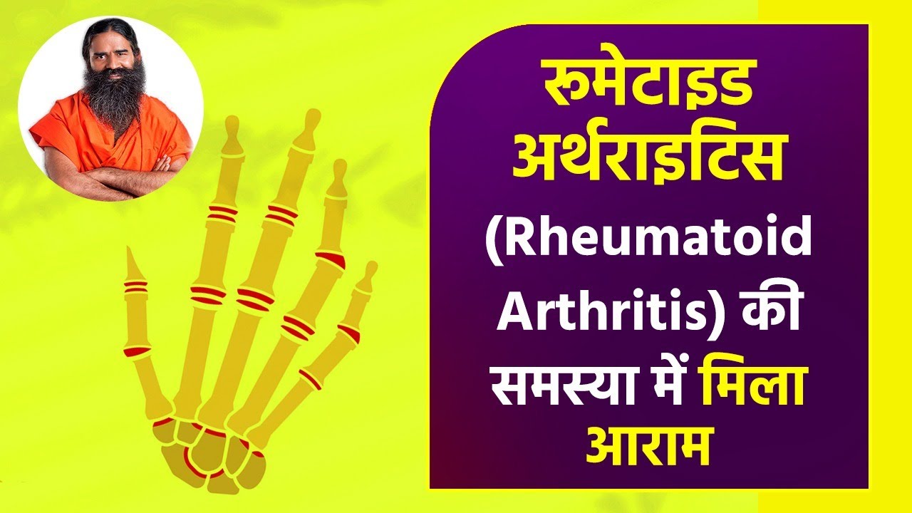 रूमेटाइड अर्थराइटिस (Rheumatoid Arthritis) की समस्या में मिला आराम Swami Ramdev YouTube
