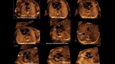 12_DIAGNOSTIC PLANES