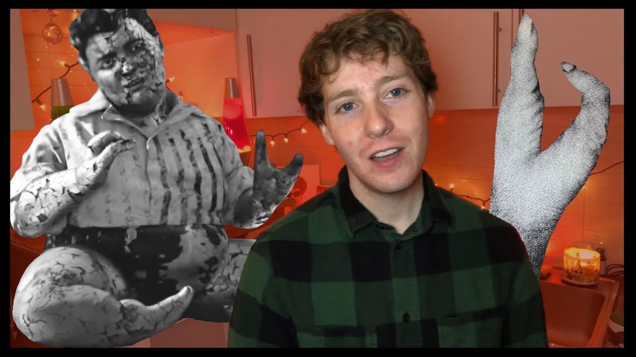 The Murderous Life of Lobster Boy YouTube