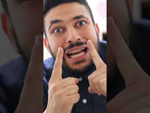 كان جاء كل شيء يتكلم حلو العيد