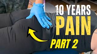 She Flew From The UK For 10 Year Tailbone Pain… Then This Happened Part 2