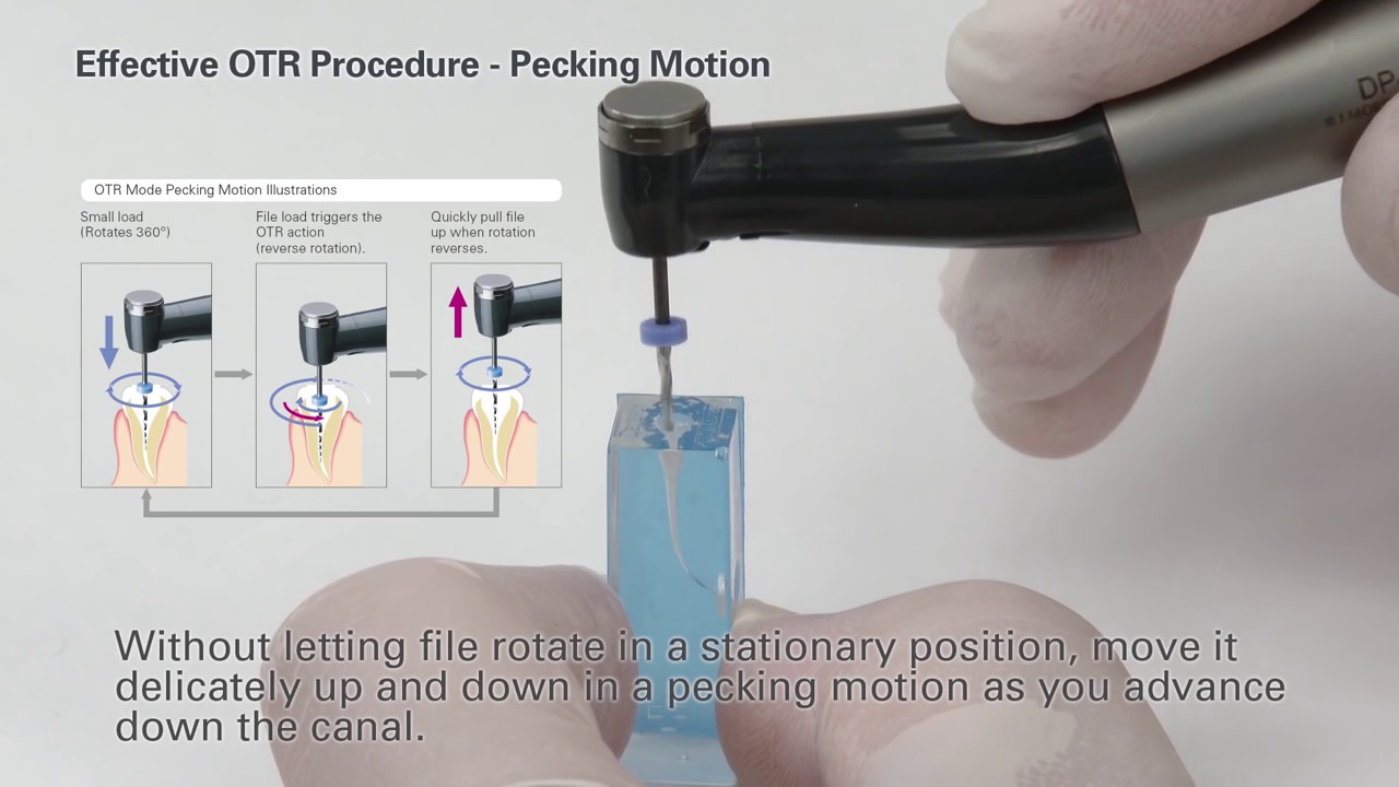 How to Use Root ZX II OTR Module