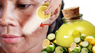 Vitamin C Serum | Remove Dark Spots Sun Tan & Pigmentation | Vitamin C for Skin Whitening