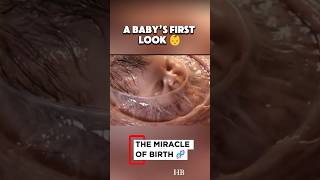 A Baby’s Face During Birth — An Incredible First Look!👶#shortsfeed