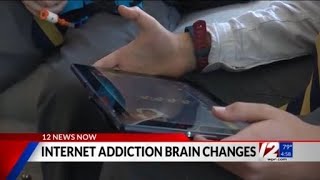 Famous Adolescents diagnosed with internet addiction can undergo brain changes Profile