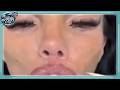Katie Price La sua lotta con la chirurgia estetica continua