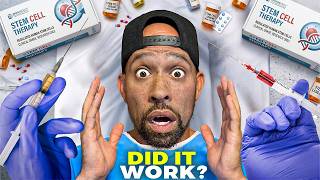 I SPENT Thousands on STEM CELLS… Was it WORTH it? My experience with STEM CELLS after a FULL Year...