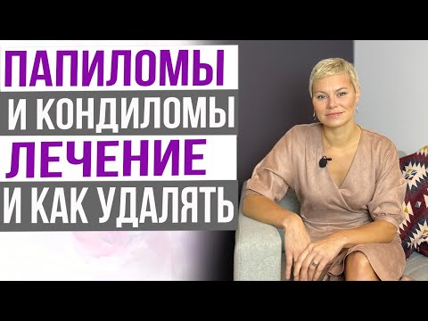 ВПЧ! Папилломы и кондиломы, лечение. Как лучше удалять. Врача Екатерина Волкова.