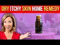 Dr janines dry itchy skin home remedy