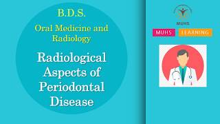 Radiological Aspects of Periodontal Disease | Oral Medicine and Radiology | BDS | 00854 | PPT Only