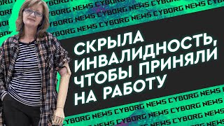 картинка: 50 лет проходила с одним протезом руки, наконец-то решила обновиться. Трансплантация или Киберпанк?
